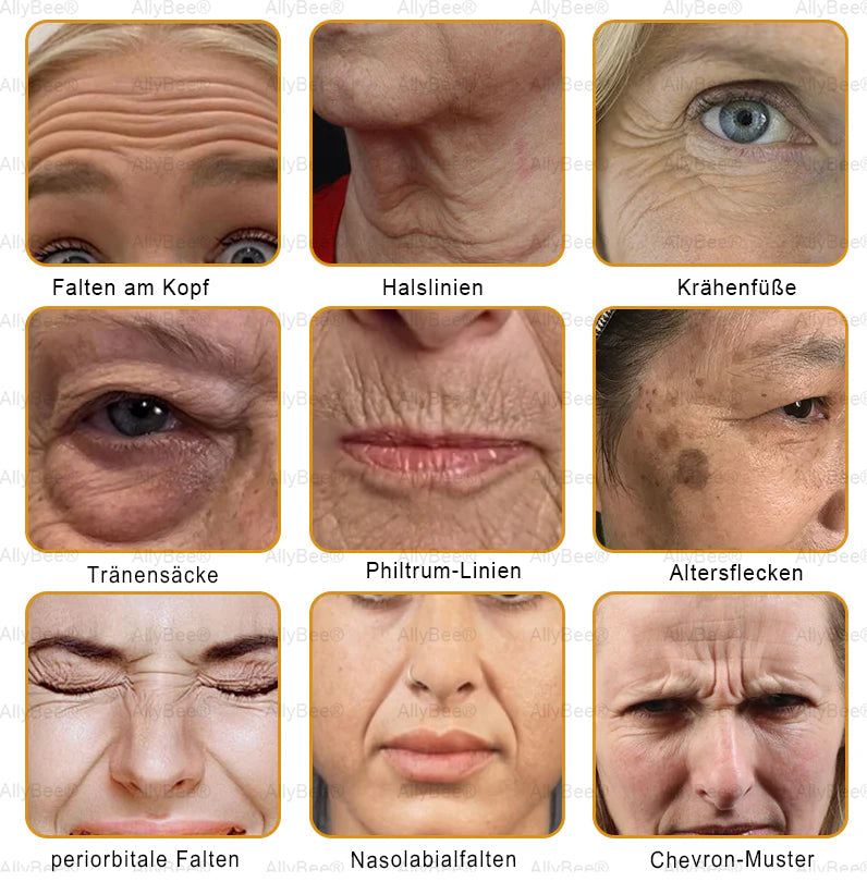 🐝🎁Letzte Chance! 70 % RABATT auf Hautreparaturcreme. Narben verblassen, die Haut wird glatter und der natürliche Glanz kommt. Kostenloser Versand und 180 Tage risikofrei.