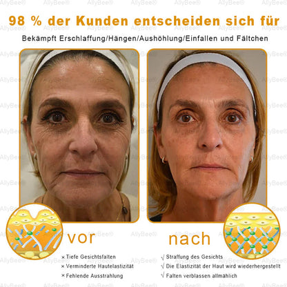 🐝🎁Letzte Chance! 70 % RABATT auf Hautreparaturcreme. Narben verblassen, die Haut wird glatter und der natürliche Glanz kommt. Kostenloser Versand und 180 Tage risikofrei.