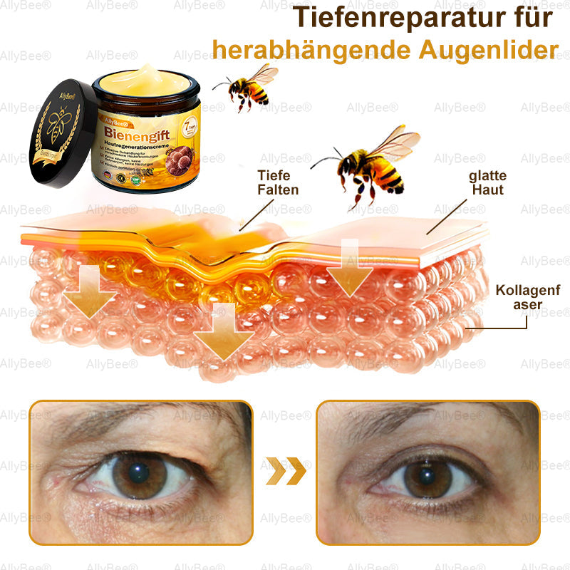 🐝🎁Letzte Chance! 70 % RABATT auf Hautreparaturcreme. Narben verblassen, die Haut wird glatter und der natürliche Glanz kommt. Kostenloser Versand und 180 Tage risikofrei.