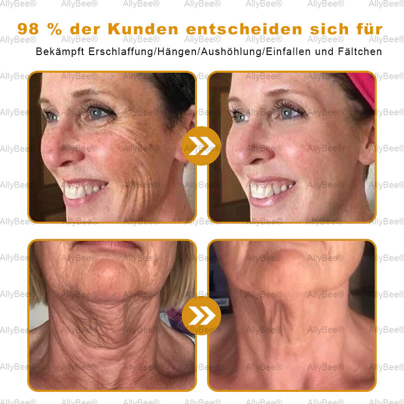 🐝🎁Letzte Chance! 70 % RABATT auf Hautreparaturcreme. Narben verblassen, die Haut wird glatter und der natürliche Glanz kommt. Kostenloser Versand und 180 Tage risikofrei.